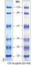 20-120kDa Mid Range Protein Molecular Weight Marker, Prestained